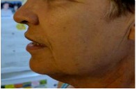 anti-aging-after