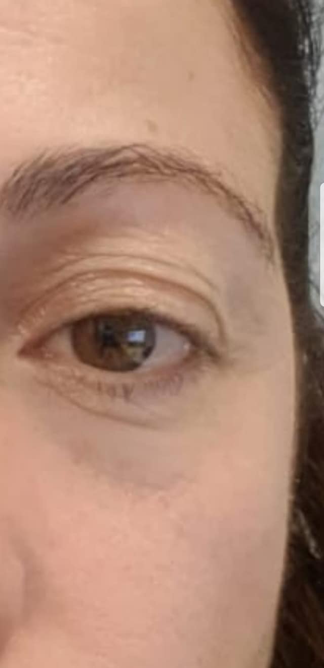 eye-hanit-after