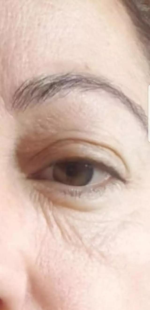 eye-hanit-before